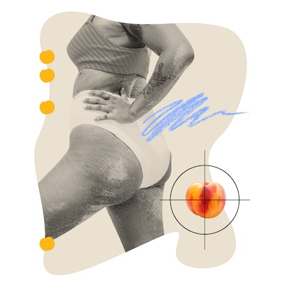 Doctors explain the Brazilian Butt Lift, along with the benefits, side effects, and costs involved.